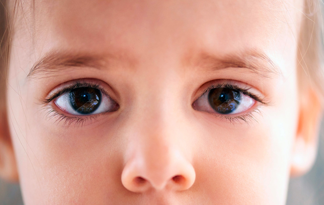 Дитина одне око менше. Різні очі у немовляти