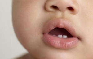 Чи може бути висип у дитини. Висип у дитини під час прорізування зубів: чи може цей процес викликати алергію і що таке цитокіновий вибух? Чому виникає висип