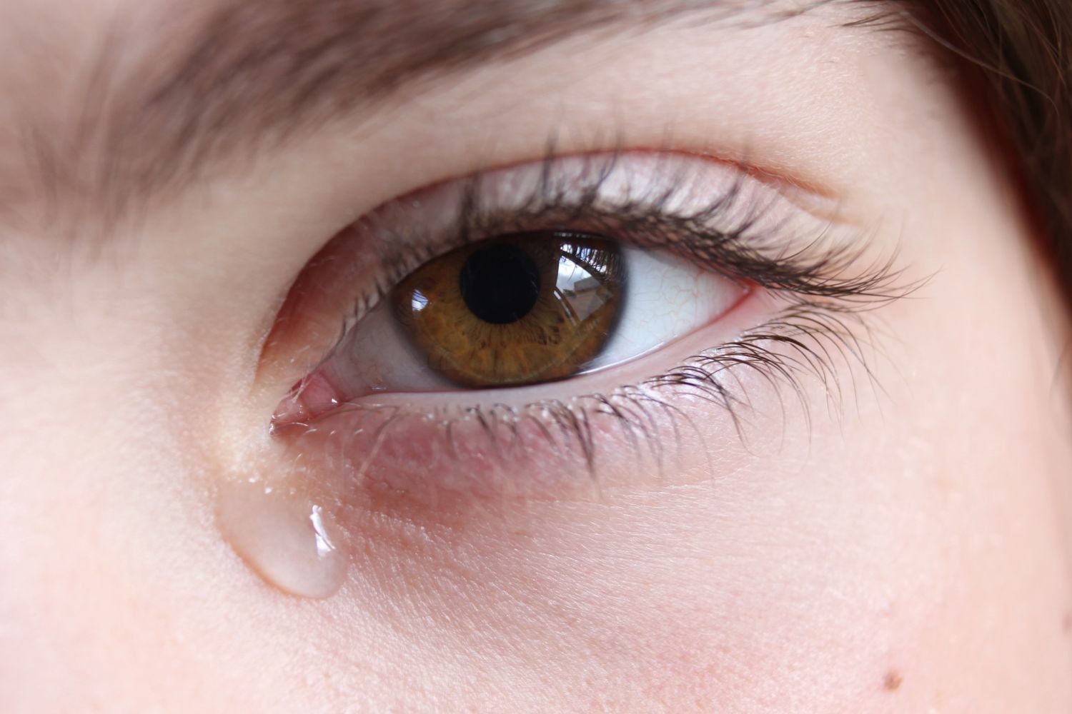 Сильно течуть сльози з очей що робити. Що робити якщо сльозяться очі? Лікування в домашніх умовах.