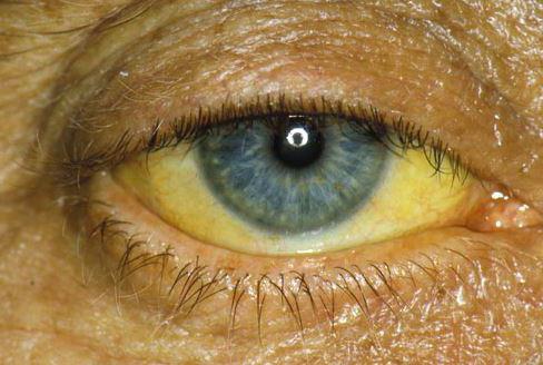 Колір очей і характер - Персональний блог The Juise. Жовтий колір очей: що це може означати