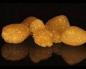 Сечокам'яна хвороба (МКБ) - камені в нирках і сечовивідних шляхах Які камені не видно на узі нирок