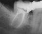 Рентгенологічне дослідження у стоматології Стандартизація рентгенологічного обстеження