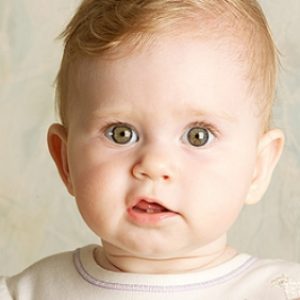 نوزاد تازه به دنیا آمده هنگام خواب چشمانش را می چرخاند. چرخش چشم در کودکان و بزرگسالان به عنوان نشانه هیدروسفالی. چرخش چشم به عنوان نشانه ای از سندرم هیدروسفالیک