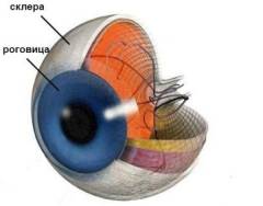 Bilochna Obolonka.  Kırmızı gözler.  Siyah gözlerin nedenleri, nedenleri ve patolojisinin tanısı.