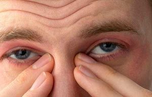 بیماری های مرتبط با دید بیماری های دید ما: یک لیست