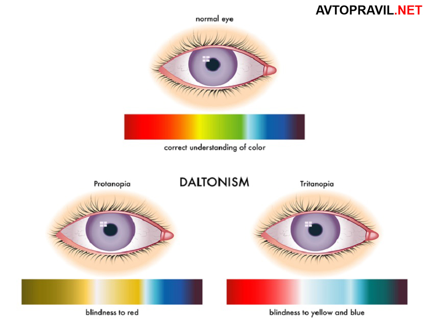 Što oftalmolog provjerava tijekom liječničkog pregleda za licencu. S takvom vizijom prava se ne mogu vidjeti. Kako se ispituje percepcija boja