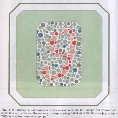 نقاشی برای دیدن بینایی در ادراک رنگ. نقض دید رنگی طبقه بندی اختلالات تصور رنگ مادرزادی با توجه به Nyberg-Rautianu-Yustova