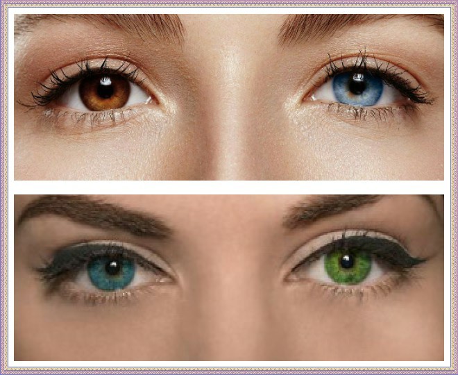 چشمها را از بین می برد هنگامی که چشم یک فرد بسته بیماری است. داروهای طب سنتی برای فشار چشم