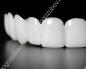 Kako staviti ljuskice na zube - metode i preporuke stomatologa Furniri za zube upute za uporabu