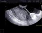 Na koji dan menstrualnog ciklusa je bolje napraviti ultrazvučni pregled maternice Kada je bolje napraviti ultrazvučni pregled u ginekologiji?